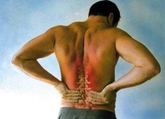 Ցավ Lumbar Osteochondrosis- ի համար